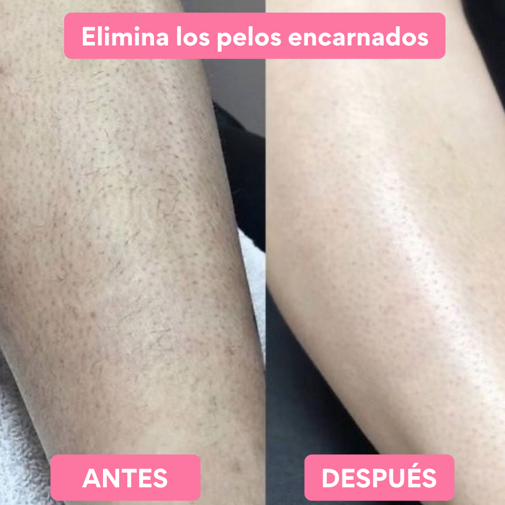 Myskin® Depilador Exfoliante de Cristal