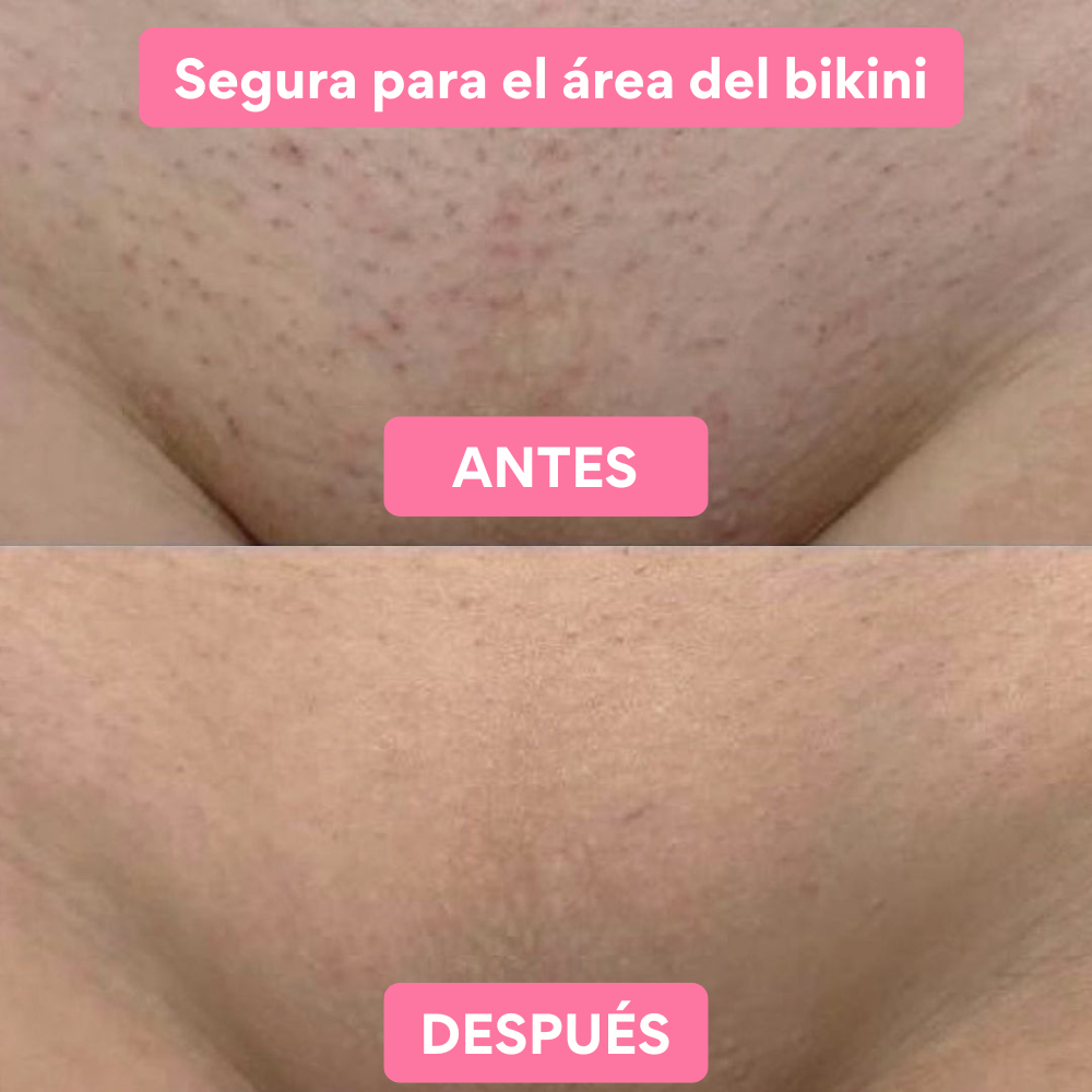 Myskin® Depilador Exfoliante de Cristal