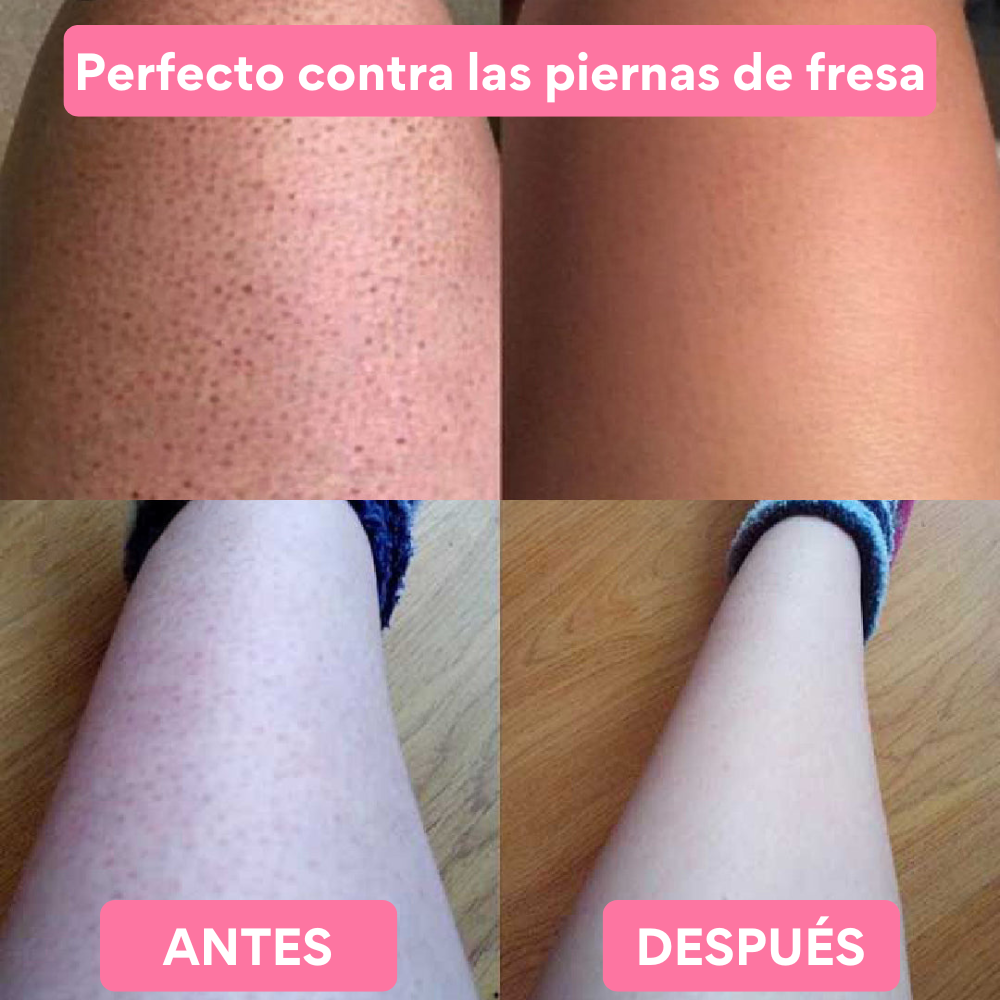 Myskin® Depilador Exfoliante de Cristal